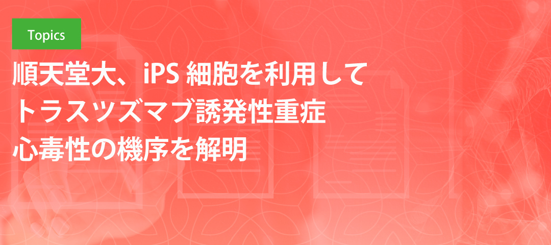 順天堂大、iPS細胞を利用してトラスツズマブ誘発性重症心毒性の機序を解明