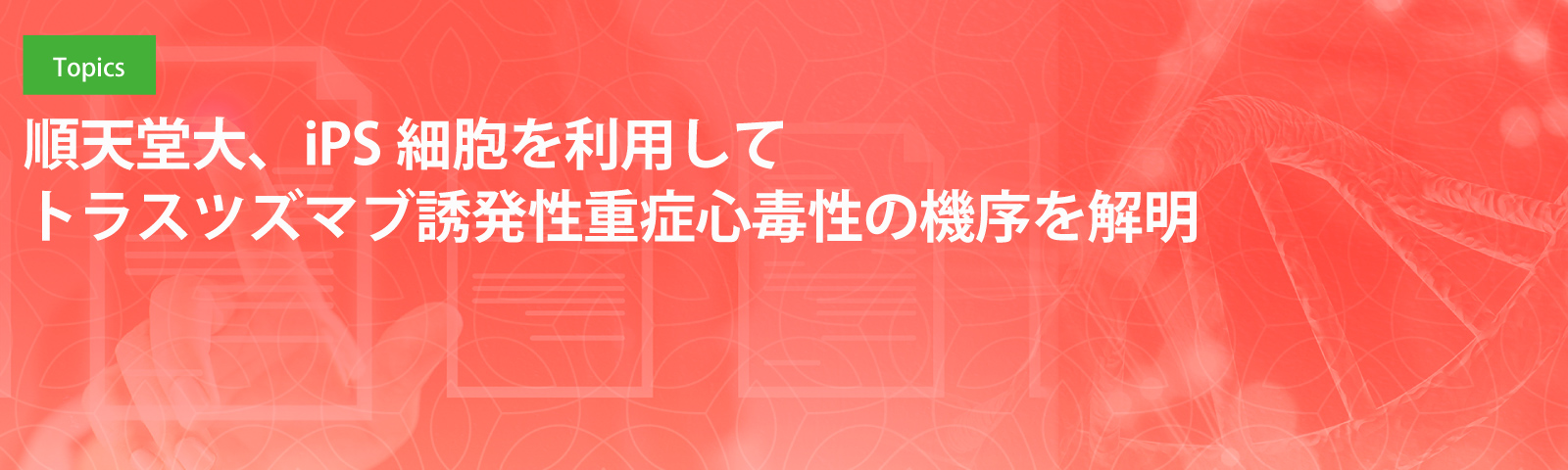 順天堂大、iPS細胞を利用してトラスツズマブ誘発性重症心毒性の機序を解明
